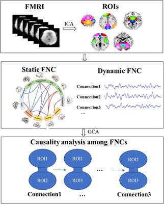 Causality Analysis to the Abnormal Subcortical–Cortical Connections in Idiopathic-Generalized Epilepsy